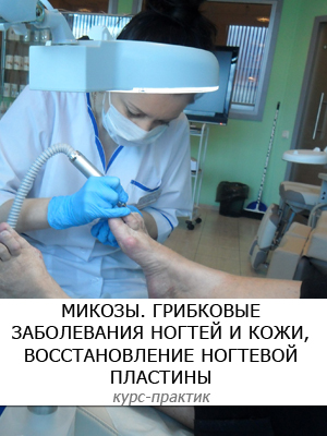 Микозы. Грибковые заболевания ногтей и кожи, восстановление ногтевой пластины - Курс-практик Наутилус